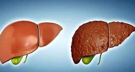 開封哪家醫(yī)院看肝病好