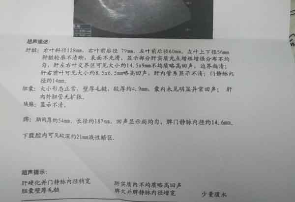 ]X≠]},ҕz錧(do)¸Ӳİl(f)